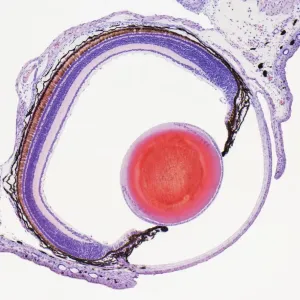 Frog Eye Print, a light micrograph of a frog's eye section