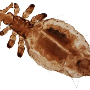 Human head louse print, x25 magnification