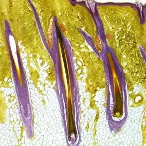 Human skin cross-section print, showing hair follicles and layers