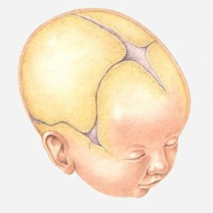 Illustration of Coronal Suture on head of newborn baby