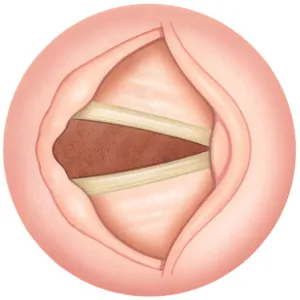 Illustration of open human vocal fold to inhale air, also known as vocal cords