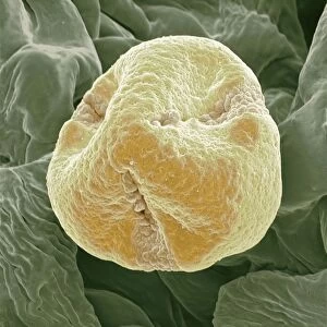 Kiwi fruit pollen grain, SEM