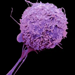 Macrophage Print, SEM Image of a White Blood Cell