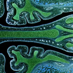 Nasal sinuses, LM Nasal sinuses, LM