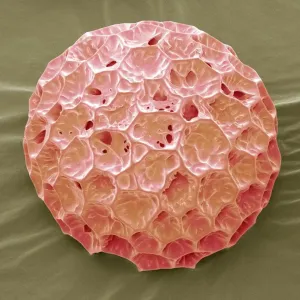Phlox pollen, SEM Phlox pollen, SEM