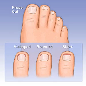 Showing a proper way to cut toe nails versus and improper way, shown as a rounded cut