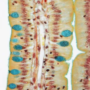 Small intestine, LM Small intestine, LM