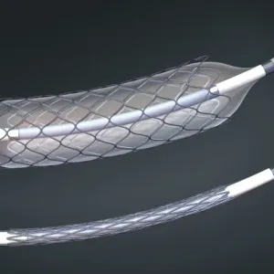 Stents and balloon catheters, illustration Stents and balloon catheters, illustration