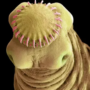 SEM Print of Taenia solium Cysticercus