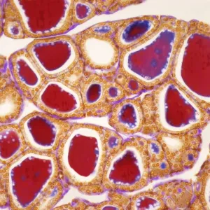 Thyroid, LM Thyroid, LM