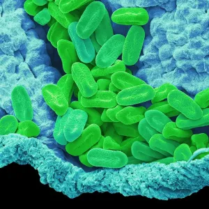 Verbena pollen, SEM Verbena pollen, SEM