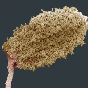 Wood anemone anther, SEM Wood anemone anther, SEM