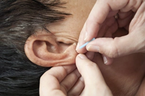 Images Dated 30th November 2012: Acupuncture treatment