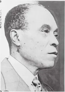 Old Age Prints: African American Suffering from Rare Skin Disease
