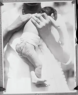 Infancy Prints: Baby Girl Born with Tail