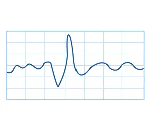 Forecasting Prints: Biomedical illustration of electromyography (EMG) result