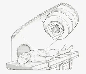 Lying On Back Prints: Black and white illustration of a patient undergoing radiation therapy