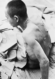 Suffering Prints: The Blistered Back of Young Wei Tso-Kan