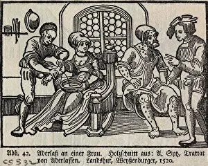 Bloodletting Prints: Bloodletting of Woman