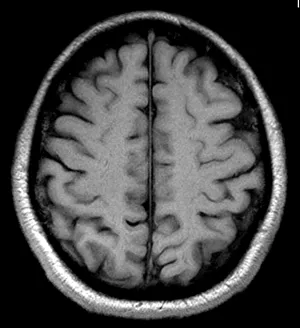 Images Dated 26th June 2012: Brain MRI