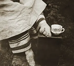 Teacup Prints: Chinese Woman's Feet Distorted by Foot Binding Practice