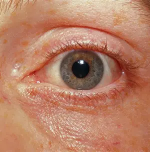 Close Up of Human Eye with Pupil Contracting