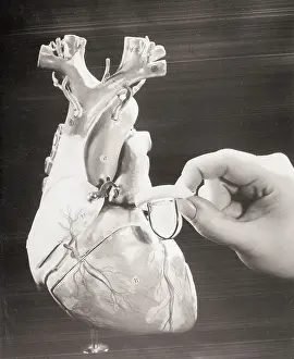 Organ Prints: Close-Up of Artificial Heart Valve
