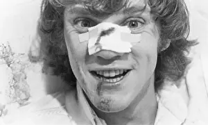 Nose Prints: Closeup Of Malcolm Mcdowell W/Bloody Nos