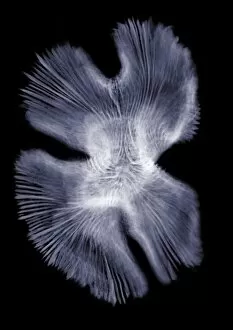 Delicate Gallery: Coral, X-ray