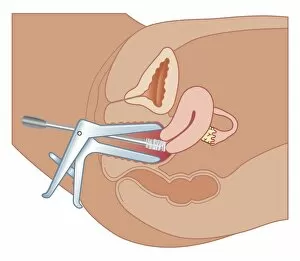 Images Dated 21st October 2011: Cross section biomedical illustration of Papanicolaou test (cervical smear) using speculum