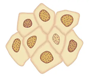Dividing Prints: Cross section biomedical illustration of cancer cells forming tumour at third doubling stage