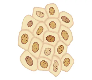Dividing Prints: Cross section biomedical illustration of cancer cells forming tumour at fourth doubling stage