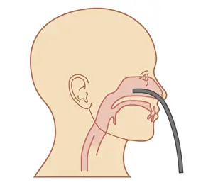 Cross section biomedical illustration of endoscope inserted through nose for Anterior Rhinoscopy procedure