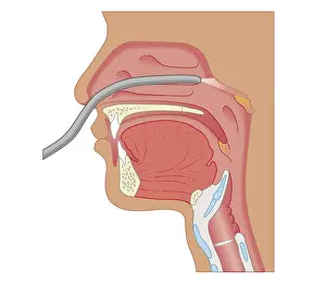 Nose Prints: Cross section biomedical illustration of endoscopy of the nose and throat