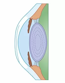 Images Dated 24th October 2011: Cross section biomedical illustration of human eye before corrective surgery for myopia