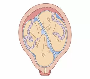 Twin Gallery: Cross section biomedical illustration of identical twins in uterus sharing placenta