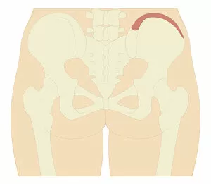 Images Dated 21st October 2011: Cross section biomedical illustration of iliac crest site on pelvis