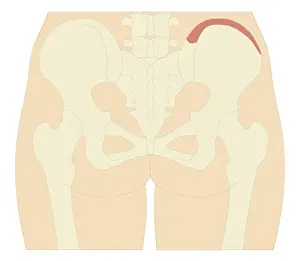 Cross section biomedical illustration of iliac crest site on pelvis