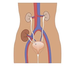 Images Dated 21st October 2011: Cross section biomedical illustration of kidney transplant