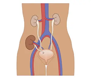 Artery Prints: Cross section biomedical illustration of kidney transplant