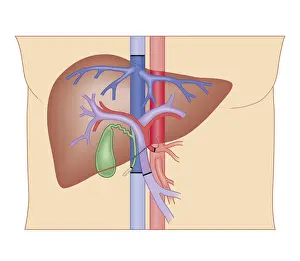 Artery Prints: Cross section biomedical illustration of liver transplant procedure