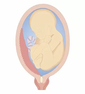 Images Dated 24th October 2011: Cross section biomedical illustration of marginal placenta praevia