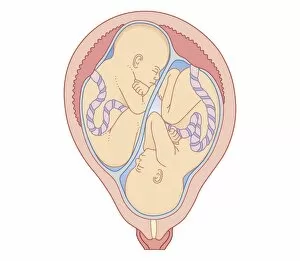 Twin Gallery: Cross section biomedical illustration of non identical twins in uterus with separate placentas