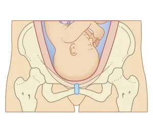 Uterus Prints: Cross section biomedical illustration of position of head of foetus before engagement process