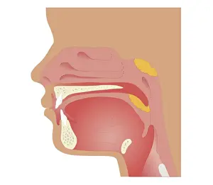 Tongue Prints: Cross section biomedical illustration of sites of tonsilectomy and adenoidectomy procedures