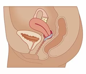 Images Dated 21st October 2011: Cross section biomedical illustration of vaginal ring in position