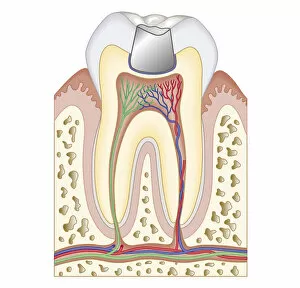 Images Dated 24th October 2011: Cross section biomedical illustrationBiomedical illustration of dental filling