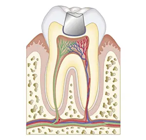 Roots Prints: Cross section biomedical illustrationBiomedical illustration of dental filling