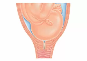 Cross section digital illustration of head of foetus in pelvis, pushing against cervix as labour nears