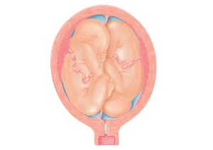 Uterus Prints: Cross section digital illustration showing normal and breech positions